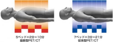 最新型PET/CT、右図：従来型PET/CT