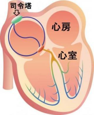心臓のイメージ図